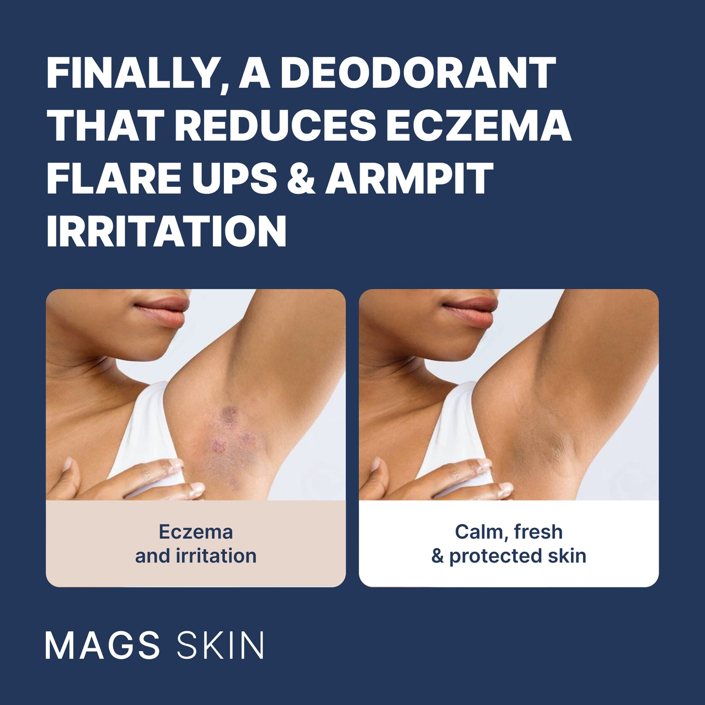 MAGS Skin Deodorant Pre-Order (Ships August 2025)