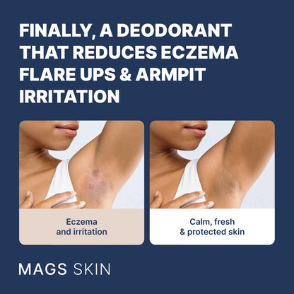 MAGS Skin Deodorant Pre-Order (Ships August 2025)